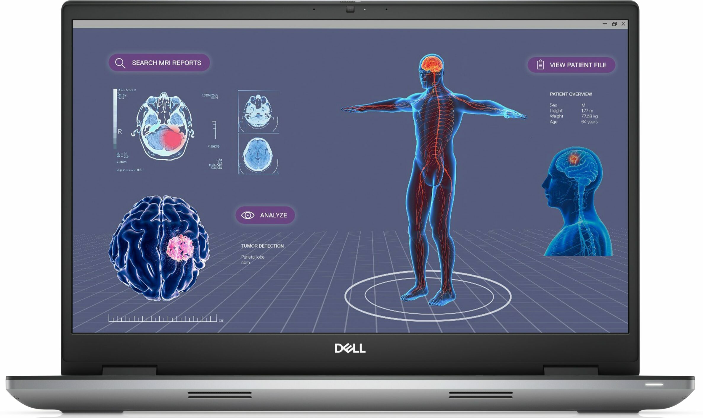 Precision 17 7780 Dell Precision 17 7780 — Intel® Core™ I7-13850Hx Cpu@2,77Ghz Rtx 2000 8Gb Ddr6 Graphics Card - Image 1